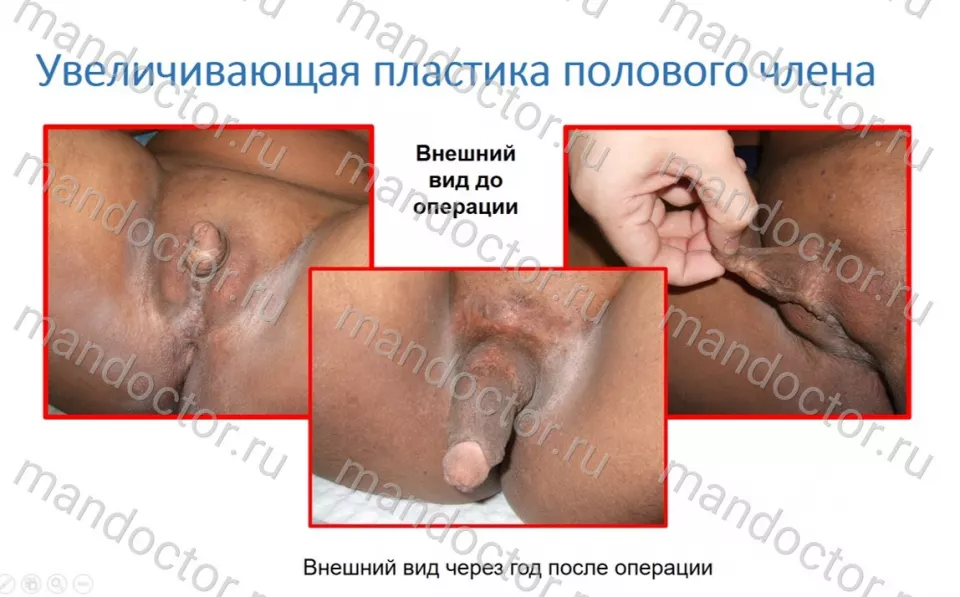 Фото пациента