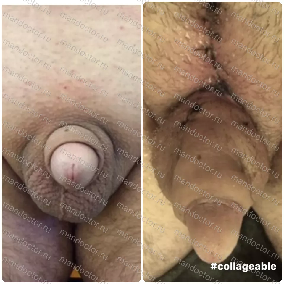 Фото пациента