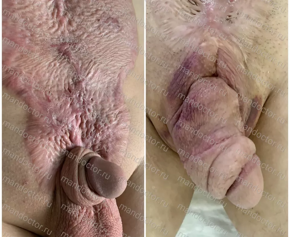 Фото пациента