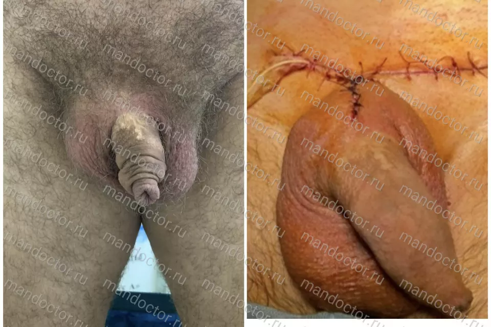 Фото пациента