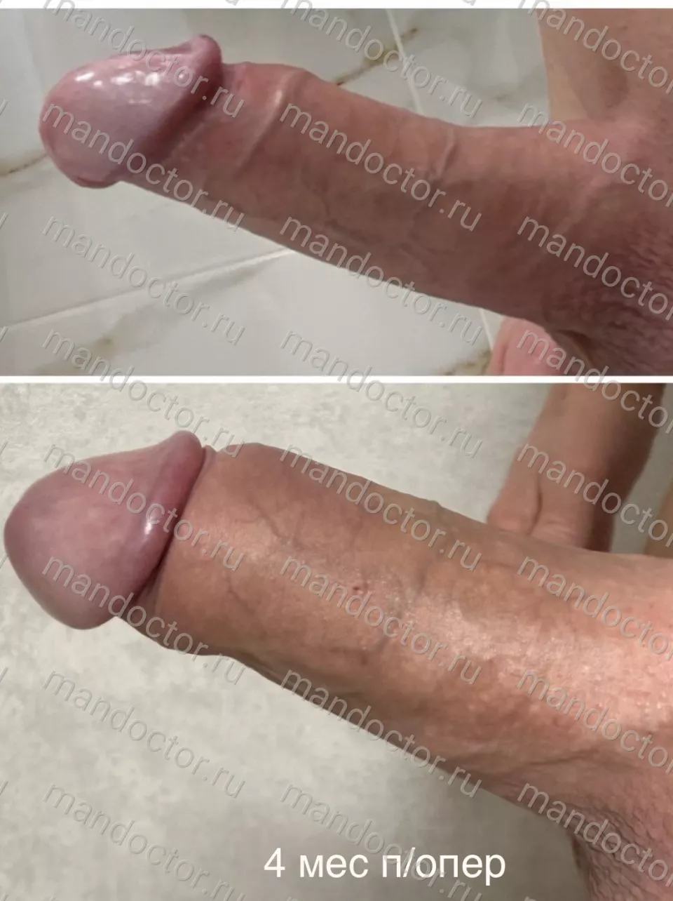 Тот же пациент